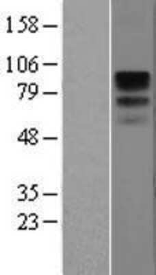 Western Blot: CD19 Overexpression Lysate [NBL1-08913]