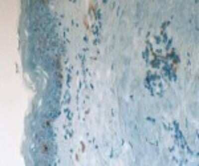 Immunohistochemistry: CD1a Antibody (201B5.08) [DDX0081P-100]