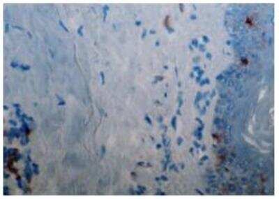 Immunohistochemistry: CD1a Antibody (214A9.01) [DDX0080P-100]