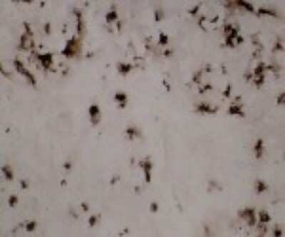 Immunohistochemistry-Frozen: CD1a Antibody (214A9.01) [DDX0080P-100]