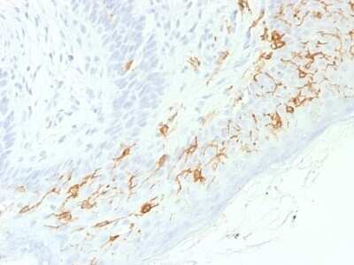 Immunohistochemistry-Paraffin: CD1a Antibody (C1A/1506R) - Azide and BSA Free [NBP2-54547]