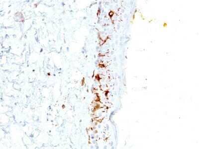 Immunohistochemistry-Paraffin: CD1a Antibody (C1A/711) - Azide and BSA Free [NBP2-34574]