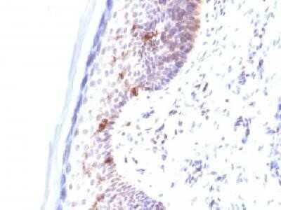 Immunohistochemistry-Paraffin: CD1a Antibody (C1A/711) - IHC-Prediluted [NBP2-45343]