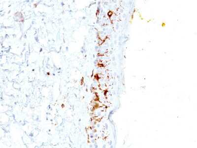 Immunohistochemistry-Paraffin: CD1a Antibody (C1A/711) [NBP2-33018]