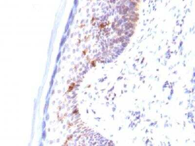 Immunohistochemistry-Paraffin: CD1a Antibody (C1A/711) [NBP2-33018]