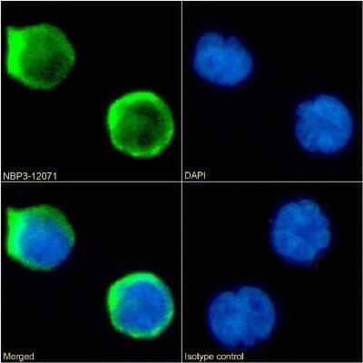 Immunocytochemistry/ Immunofluorescence: CD1a Antibody (CBT6) - Chimeric - Azide and BSA Free [NBP3-12071]