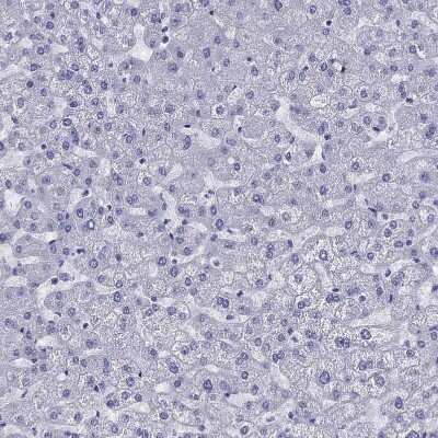 Immunohistochemistry-Paraffin: CD1a Antibody [NBP1-86560]