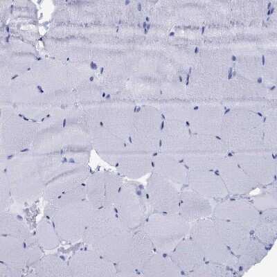 Immunohistochemistry-Paraffin: CD1a Antibody [NBP1-86560]