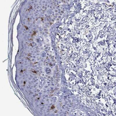 Immunohistochemistry-Paraffin: CD1a Antibody [NBP1-86560]