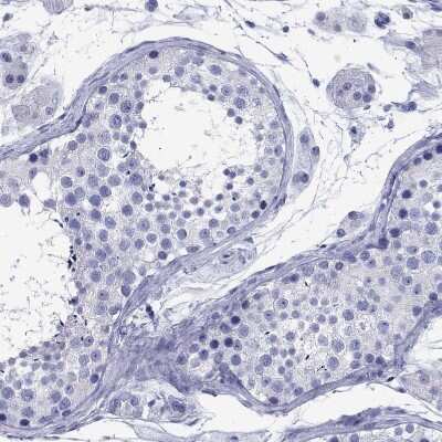 Immunohistochemistry-Paraffin: CD1a Antibody [NBP1-86560]