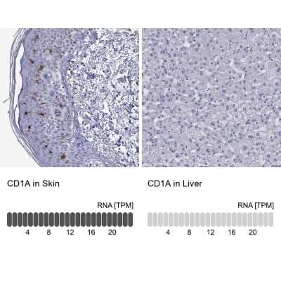 Immunohistochemistry-Paraffin: CD1a Antibody [NBP1-86560]