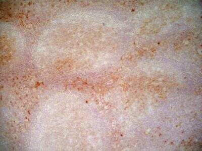 Immunohistochemistry-Frozen: CD1a Antibody (NA1/34-HLK) - BSA Free [NB100-64852]