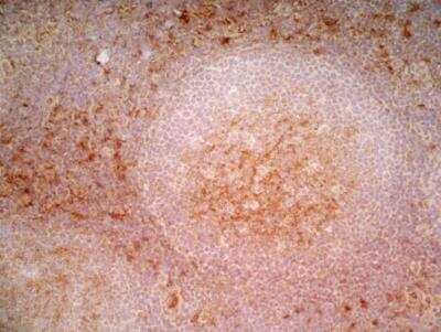 Immunohistochemistry-Frozen: CD1a Antibody (NA1/34-HLK) - BSA Free [NB100-64852]