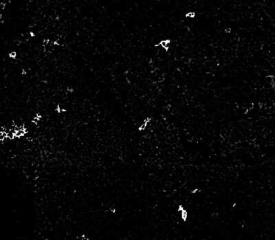 Immunohistochemistry-Paraffin: CD1a Antibody (O10+C1A/711) - Azide and BSA Free [NBP2-34698]