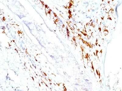 Immunohistochemistry-Paraffin: CD1a Antibody (O10+C1A/711) - Azide and BSA Free [NBP2-34698]