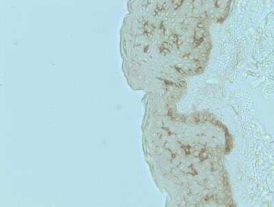 Immunohistochemistry-Paraffin: CD1a Antibody (O10) - Azide and BSA Free [NBP2-34697]
