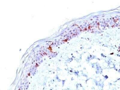 Immunohistochemistry-Paraffin: CD1a Antibody (O10) - Azide and BSA Free [NBP2-34697]