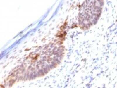 Immunohistochemistry-Paraffin: CD1a Antibody (SPM120) - Azide and BSA Free [NBP2-34731]