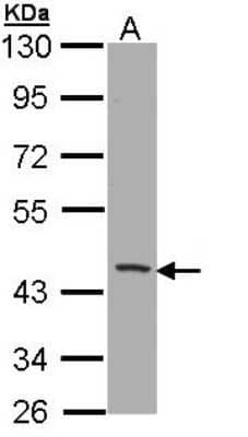 Western Blot: CD1b Antibody [NBP1-33254]