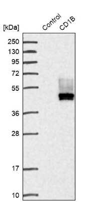 Western Blot: CD1b Antibody [NBP1-86559]