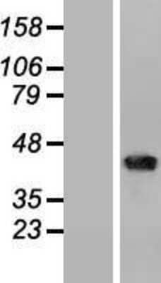 Western Blot: CD1b Overexpression Lysate [NBP2-08177]