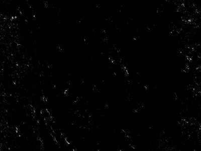 Immunohistochemistry-Paraffin: CD1c/BDCA-1 Antibody (3G1B3) - BSA Free [NBP2-61725]