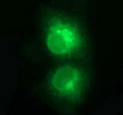 Immunocytochemistry/ Immunofluorescence: CD1c/BDCA-1 Antibody (OTI2F4) - Azide and BSA Free [NBP2-70345]