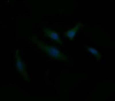 Immunocytochemistry/ Immunofluorescence: CD1c/BDCA-1 Antibody (OTI2F4) - Azide and BSA Free [NBP2-70345]