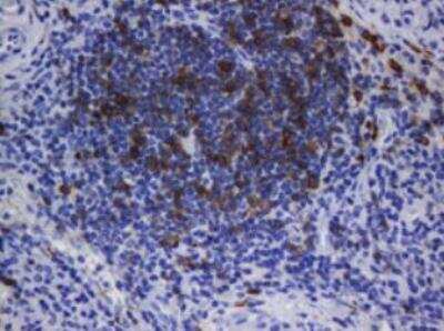 Immunohistochemistry-Paraffin: CD1c/BDCA-1 Antibody (OTI2F4) - Azide and BSA Free [NBP2-70345]