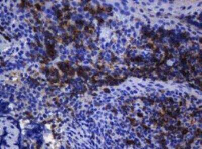 Immunohistochemistry-Paraffin: CD1c/BDCA-1 Antibody (OTI2F4) - Azide and BSA Free [NBP2-70345]