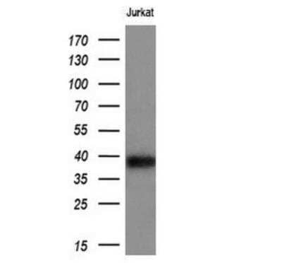Western Blot: CD1c/BDCA-1 Antibody (OTI2F4)Azide and BSA Free [NBP2-70345]