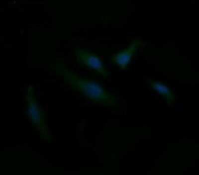 Immunocytochemistry/ Immunofluorescence: CD1c/BDCA-1 Antibody (OTI2F4) [NBP2-46123]