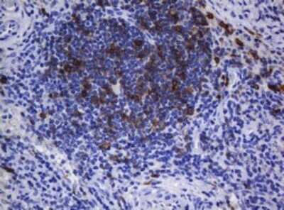 Immunohistochemistry: CD1c/BDCA-1 Antibody (OTI2F4) [NBP2-46123]