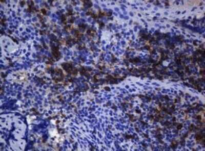 Immunohistochemistry: CD1c/BDCA-1 Antibody (OTI2F4) [NBP2-46123]