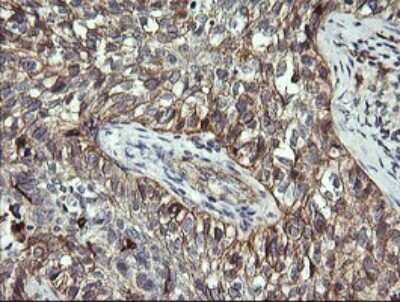 Immunohistochemistry: CD1c/BDCA-1 Antibody (OTI2F4) [NBP2-46123]