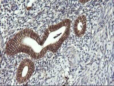 Immunohistochemistry: CD1c/BDCA-1 Antibody (OTI2F4) [NBP2-46123]