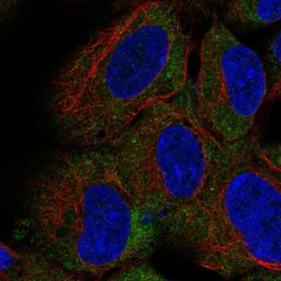 Immunocytochemistry/ Immunofluorescence: CD1d Antibody [NBP2-57561]