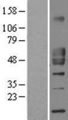 Western Blot: CD1d Overexpression Lysate [NBL1-08914]