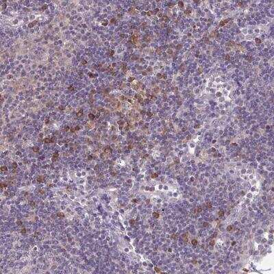 Immunohistochemistry-Paraffin: CD1e Antibody [NBP2-31691]