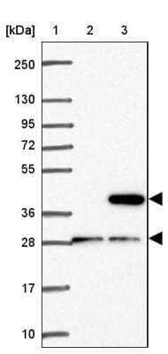 Western Blot: CD1e Antibody [NBP2-31691]