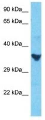 Western Blot: CD1e Antibody [NBP3-10790]