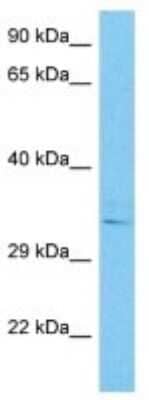 Western Blot: CD1e Antibody [NBP3-10816]