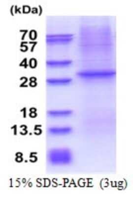 SDS-PAGE: Recombinant Human CD1e His Protein [NBP2-51622]