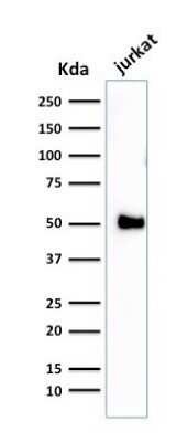 Western Blot: CD2 Antibody (1E7E8.G4)Azide and BSA Free [NBP2-34523]