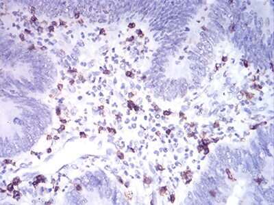 Immunohistochemistry-Paraffin: CD2 Antibody (3D1E3) - BSA Free [NBP2-61727]