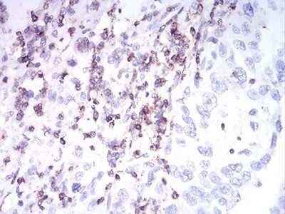 Immunohistochemistry-Paraffin: CD2 Antibody (3D1E3) - BSA Free [NBP2-61727]