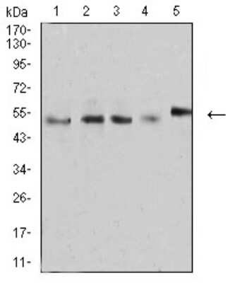 Western Blot: CD2 Antibody (3D1E3)BSA Free [NBP2-61727]