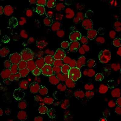 Immunocytochemistry/ Immunofluorescence: CD2 Antibody (BH1) [NBP2-32926]