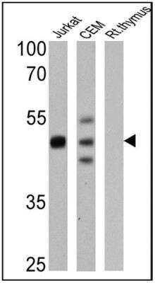Western Blot: CD2 Antibody (TS2/18)Azide and BSA Free [NBP2-22537]