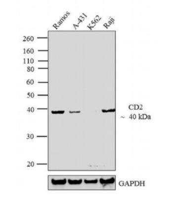 Western Blot: CD2 Antibody (TS2/18)Azide and BSA Free [NBP2-22537]